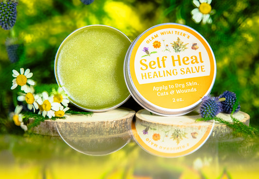 An open round tin of green self-healing salve and its labeled lid beside it, displayed on a wooden slice with chamomile flowers and blue thistles against a bright yellow-green blurred natural background.